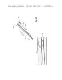 SNAP-ON VASCULAR CLOSURE DEVICE AND METHODS diagram and image