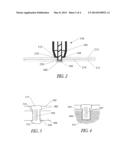 INJECTABLE FASTENER SYSTEM AND METHOD diagram and image