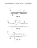 SHAPED OCCLUDING DEVICES AND METHODS OF USING THE SAME diagram and image