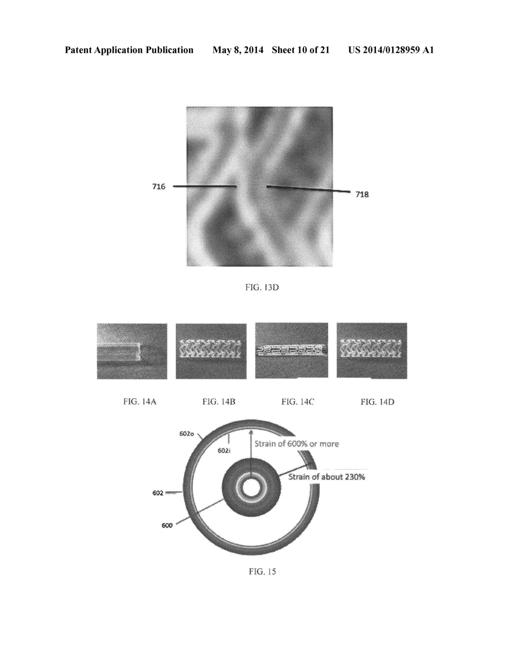 Biodegradable stent with enhanced fracture toughness - diagram, schematic, and image 11