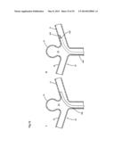 ENDOVASCULAR PROSTHESIS AND DELIVERY DEVICE diagram and image