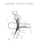 ENDOVASCULAR PROSTHESIS AND DELIVERY DEVICE diagram and image