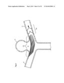 ENDOVASCULAR PROSTHESIS AND DELIVERY DEVICE diagram and image