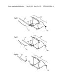 ENDOVASCULAR PROSTHESIS AND DELIVERY DEVICE diagram and image