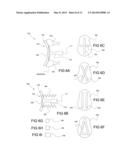 IMPLANTABLE GLENOID PROSTHESES diagram and image