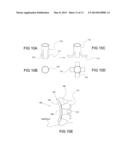 IMPLANTABLE GLENOID PROSTHESES diagram and image