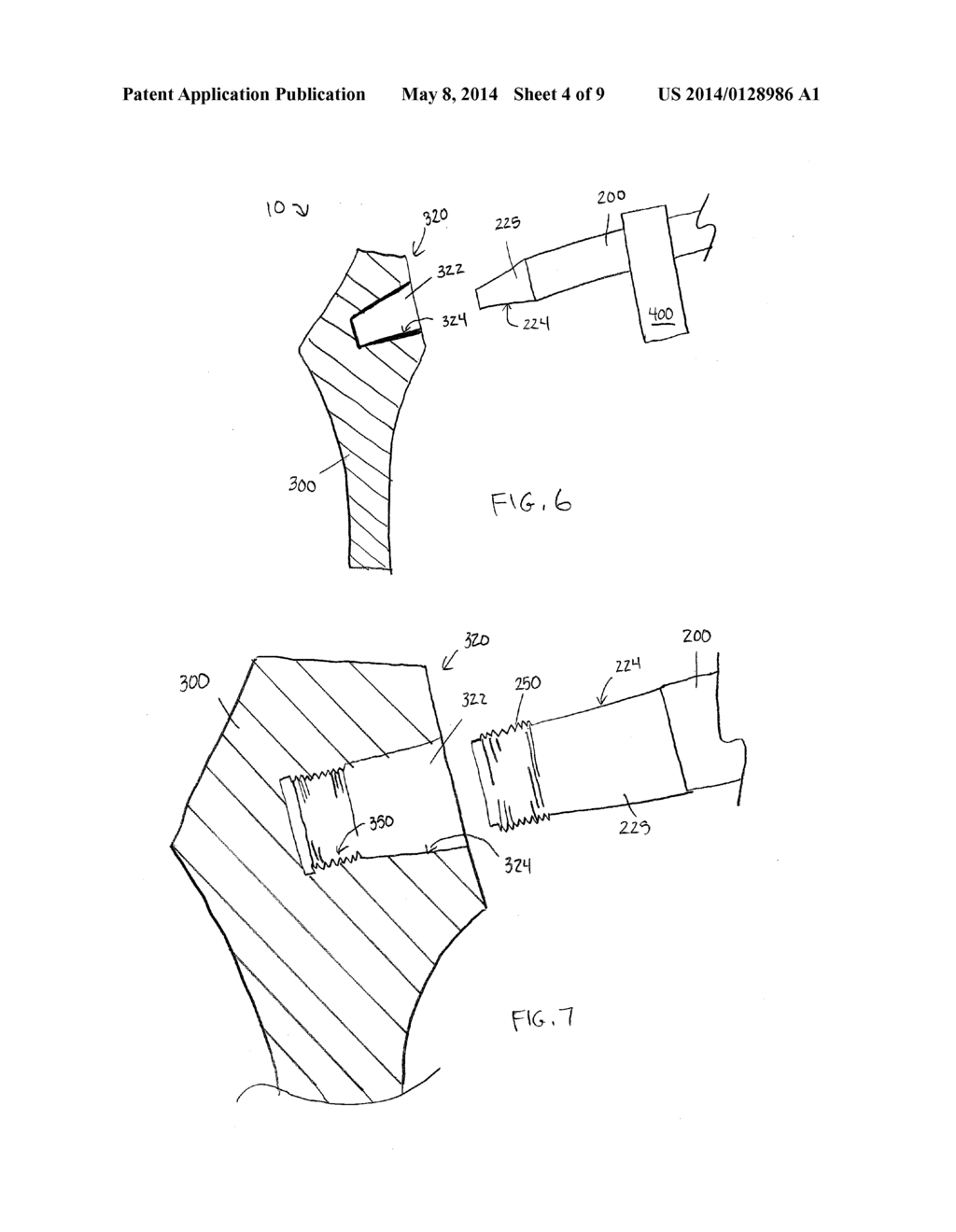 MONOBLOCK HEAD AND NECK UNIT FOR TOTAL HIP REPLACEMENT - diagram, schematic, and image 05