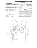 Methods and Devices for a Surgical Hip Replacement Procedure diagram and image