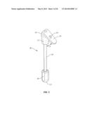 Methods and Devices for a Surgical Hip Replacement Procedure diagram and image