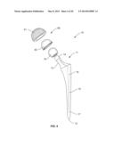 Methods and Devices for a Surgical Hip Replacement Procedure diagram and image