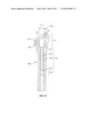 Methods and Devices for a Surgical Hip Replacement Procedure diagram and image