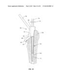 Methods and Devices for a Surgical Hip Replacement Procedure diagram and image