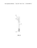 Methods and Devices for a Surgical Hip Replacement Procedure diagram and image