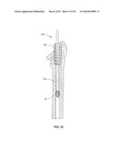 Methods and Devices for a Surgical Hip Replacement Procedure diagram and image