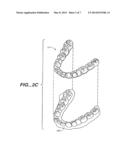 SYSTEM FOR DETERMINING FINAL POSITION OF TEETH diagram and image