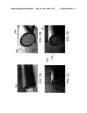 CONCENTRIC CUTTING ASSEMBLY, CONCENTRIC CUTTING SYSTEM, AND NET     PENETRATION METHOD diagram and image