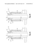 Valve Stem Seal With Gas Relief Features diagram and image