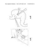 COLLAPSIBLE ANVIL HEAD AND STAPLING APPARATUS diagram and image