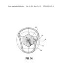 Surgical Stapler Having an Articulation Mechanism diagram and image