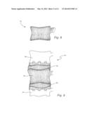 BIOLOGIC ARTIFICIAL BONE diagram and image