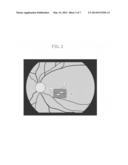 OPHTHALMOLOGIC APPARATUS, CONTROL METHOD diagram and image