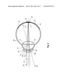 MYOPIA CONTROL MEANS diagram and image