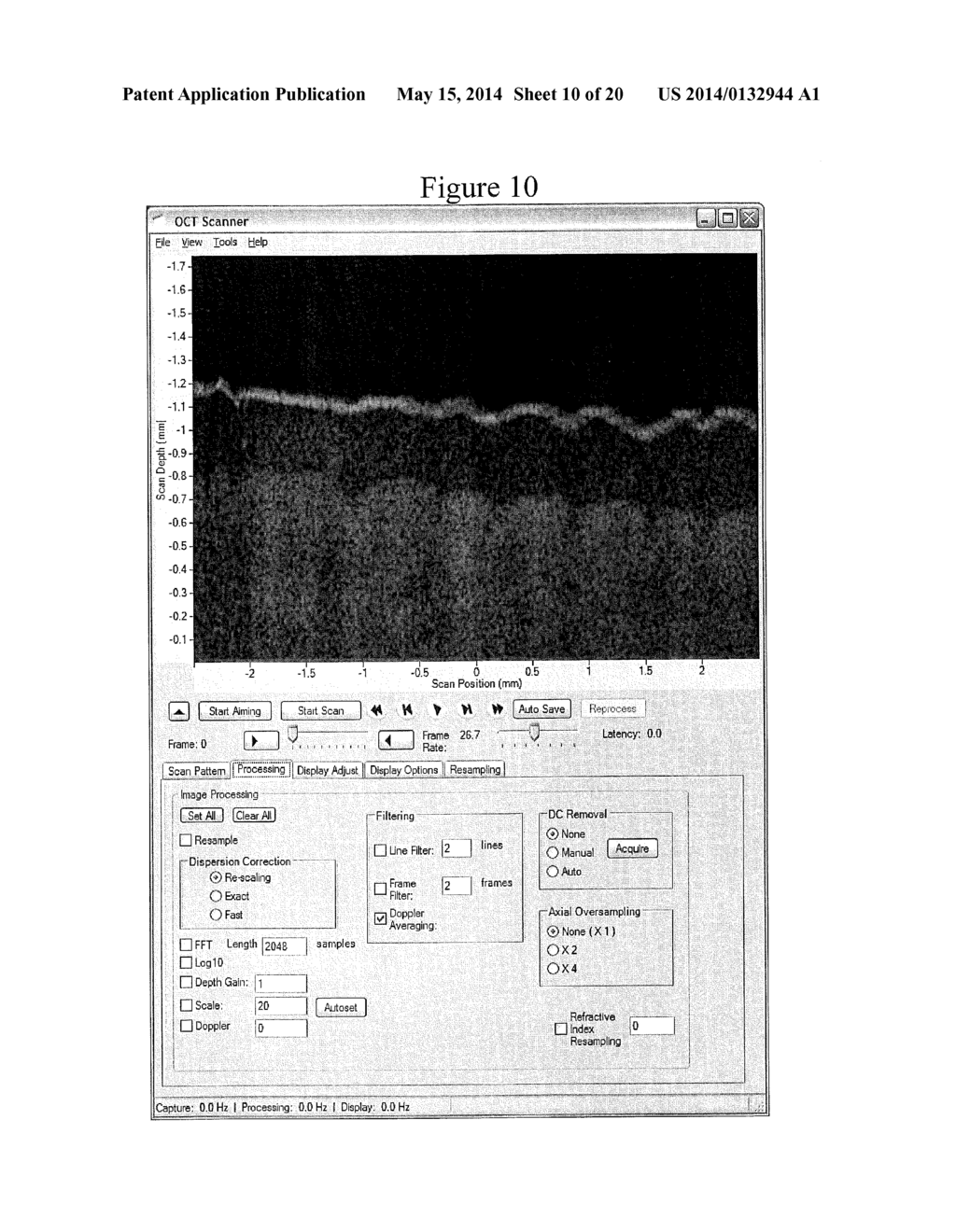 Methods, Systems and Computer Program Products for Processing Images     Generated Using Fourier Domain Optical Coherence Tomography (FDOCT) - diagram, schematic, and image 11