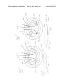 APPARATUS FOR PREVENTION OF PRESSURE TRANSIENTS IN MICROPHONES diagram and image