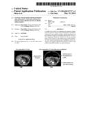 System and Method for Registering Pre-Operative and Intra-Operative Images     Using Biomechanical Model Simulations diagram and image