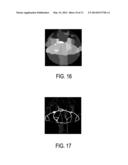 APPARATUS FOR GENERATING ASSIGNMENTS BETWEEN IMAGE REGIONS OF AN IMAGE AND     ELEMENT CLASSES diagram and image