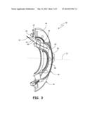 SPLIT INTERMEDIATE CASE diagram and image