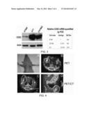 COMPOUNDS, PROBES, AND METHODS OF SYNTHESIS AND METHODS OF IMAGING     COX-2-ASSOCIATED DISEASES diagram and image