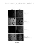 USE OF A COMBINATION OF MYXOMA VIRUS AND RAPAMYCIN FOR THERAPEUTIC     TREATMENT diagram and image