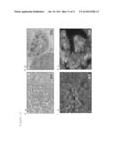 KRAS MUTATIONS AND RESISTANCE TO ANTI-EGFR TREATMENT diagram and image