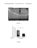 VACCINE AND METHOD FOR TREATMENT OF NEURODEGENERATIVE DISEASES diagram and image