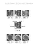 pH INDUCED SILK GELS AND USES THEREOF diagram and image