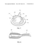 Nanoparticle Implantation In Medical Devices diagram and image