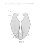 SYSTEMS AND METHOD FOR PRODUCING THREE-DIMENSIONAL ARTICLES FROM FLEXIBLE     COMPOSITE MATERIALS diagram and image