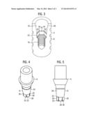 DENTAL IMPLANT SYSTEM diagram and image