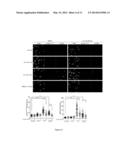 Method for Measuring ATR Inhibition mediated increases in DNA damage diagram and image