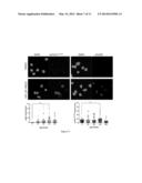 Method for Measuring ATR Inhibition mediated increases in DNA damage diagram and image