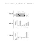 Compositions for Diagnosis and Therapy of Diseases Associated with     Aberrant Expression of Futrins (R-Spondins) and/or Wnt diagram and image