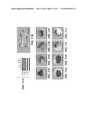 Compositions for Diagnosis and Therapy of Diseases Associated with     Aberrant Expression of Futrins (R-Spondins) and/or Wnt diagram and image