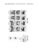 Compositions for Diagnosis and Therapy of Diseases Associated with     Aberrant Expression of Futrins (R-Spondins) and/or Wnt diagram and image