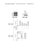 Compositions for Diagnosis and Therapy of Diseases Associated with     Aberrant Expression of Futrins (R-Spondins) and/or Wnt diagram and image