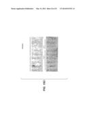 Compositions for Diagnosis and Therapy of Diseases Associated with     Aberrant Expression of Futrins (R-Spondins) and/or Wnt diagram and image