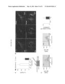 METHODS OF TREATING AUTOPHAGY-ASSOCIATED DISORDERS AND RELATED     PHARMACEUTICAL COMPOSITIONS, DIAGNOSTICS, SCREENING TECHNIQUES AND KITS diagram and image