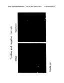 METHODS OF TREATING AUTOPHAGY-ASSOCIATED DISORDERS AND RELATED     PHARMACEUTICAL COMPOSITIONS, DIAGNOSTICS, SCREENING TECHNIQUES AND KITS diagram and image