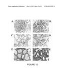 USE OF EQUOL OF TREATING ANDROGEN MEDIATED DISEASES diagram and image