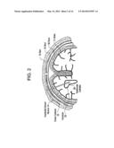 System for Transcutaneous Monitoring of Intracranial Pressure diagram and image